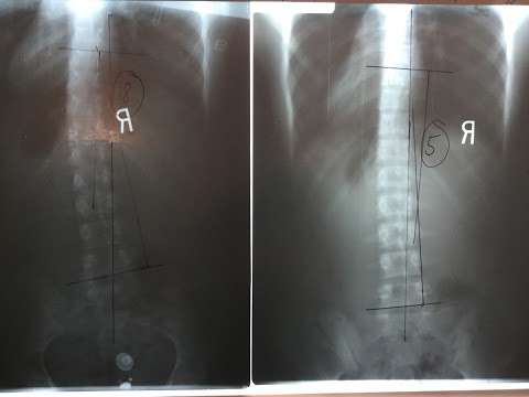Anchor Bay Spine Center Anchor Bay Spine Center